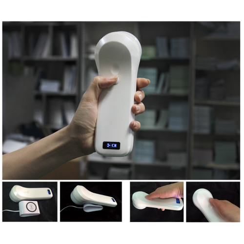 ultrasound bladder volume scanner